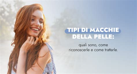 Tipi Di Macchie Della Pelle Quali Sono Come Riconoscerle E Come