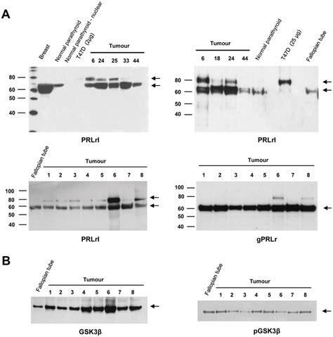 Western Blot Analysis Of Protein Expression For Gsk3β And Isoforms Of