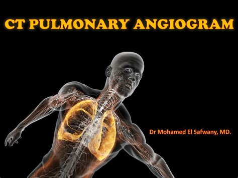 Ppt Ct Pulmonary Angiogram Powerpoint Presentation Free Download