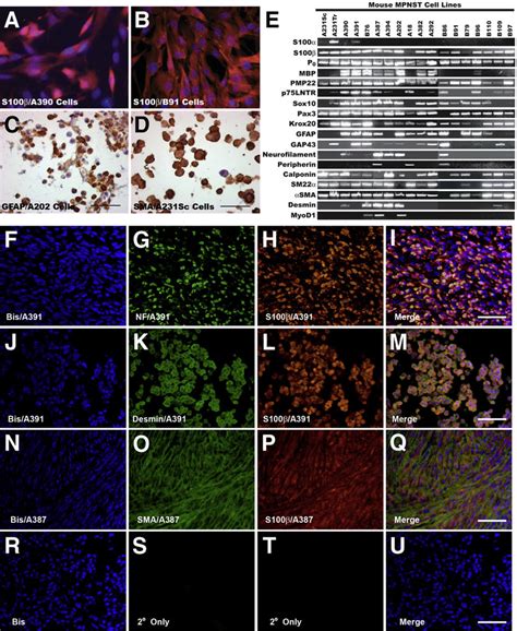 Early Passage P 0 GGFb3 MPNST Cells Consistently Express Multiple