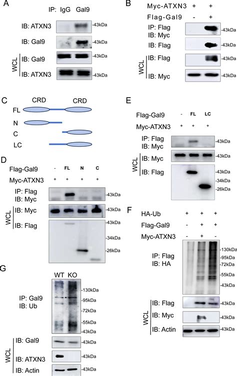 ATXN3 Functions As A Tumor Suppresser Through Potentiating Galectin 9