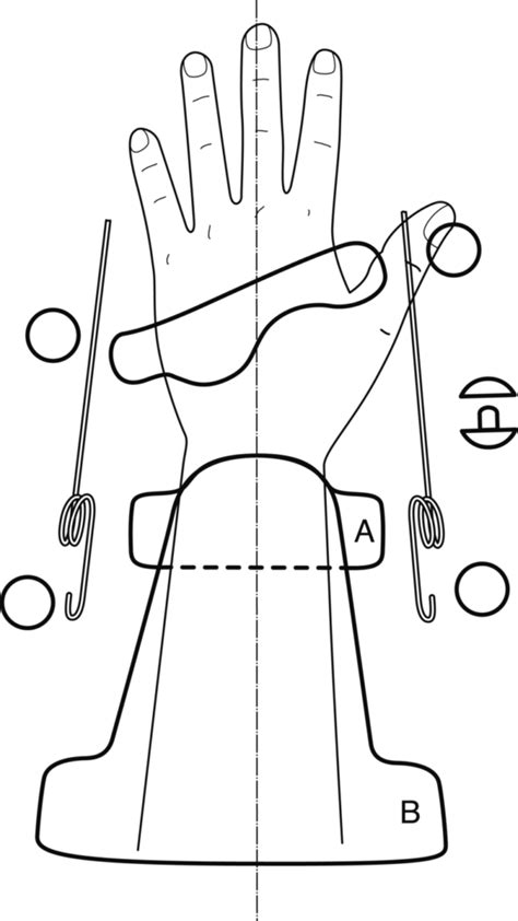 Guide Functional wrist extension - ab/adduction splint