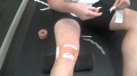 Patellar Taping For Patellofemoral Pain And Infra Patellar Fat Pad