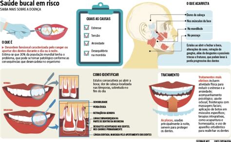 Pesadelo do Sorriso Bruxismo pode gerar trincas e fraturas e levar à