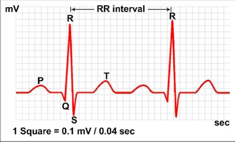 Qrs Labeled