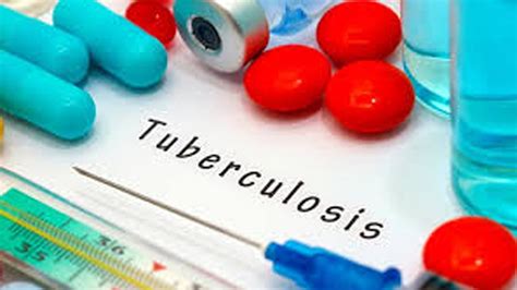 Murió Un Joven De 18 Años Por Tuberculosis En Ezpeleta Infobae