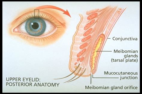 Dry Eye Syndrome/DES/MGD — Abessi Eye Care & Surgery