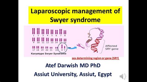 Laparoscopic Management Of Swyer Syndrome Youtube