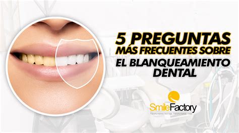 Smile Factory Las Preguntas M S Frecuentes Acerca Del