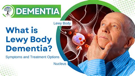 What Is Lewy Body Dementia Symptoms And Treatment Options