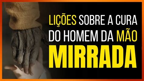 Li Es Sobre O Homem M O Mirrada Marcos S Rie Milagres De Jesus