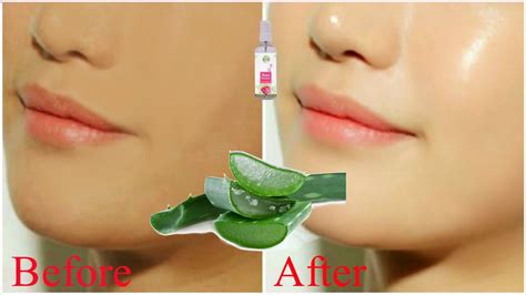 Whiten Skin Instantly Permanently At Homeskin Whitening Home Remedy