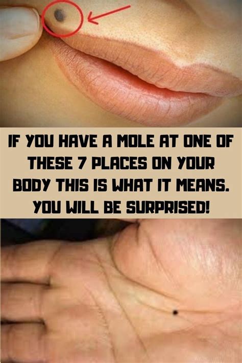 If You Have A Mole At One Of These 7 Places On Your Body This Is What It Means You Will How