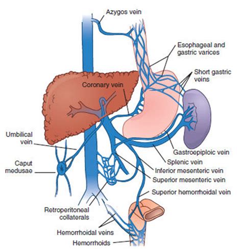 Portal Hypertension Pharmacy And Acute Care University