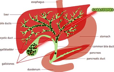 Deep Exploration Of Liver And Gallbladder Function – 266 | Medici ...