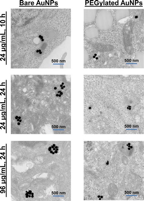 Representative Cellular Tem Images Showed Differences In Cellular Download Scientific Diagram