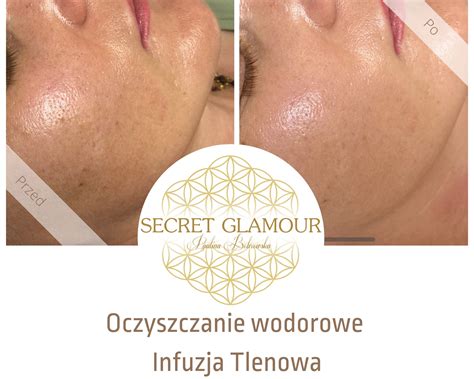 Infuzja Tlenowa Secret Glamour