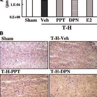 Effects Of PPT ER Agonist DPN ER Agonist And 17 Estradiol