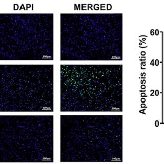 Effect Of Oxa On Apoptosis In The Cortex Following Cir Tunel Staining