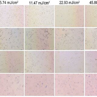 The Transmission Electron Microscopy Images Of PEG AuS On SGC 7901 And