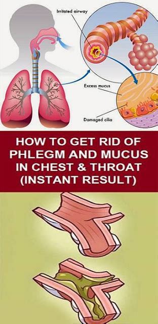 How To Get Rid Of Phlegm And Mucus In Chest Throat Instant Result