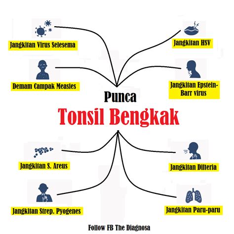 Tonsil Bengkak Punca Simptom Dan Rawatan Yang Anda Perlu Tahu Porn Sex Picture