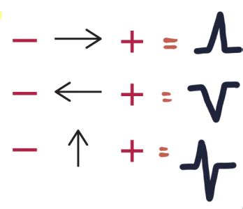 Ekg Exam Flashcards Quizlet