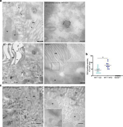 Ultrastructural Localization Of Globotriaosylceramide Gb3 In Murine