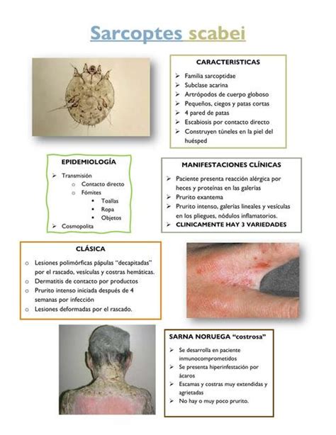 Sarcoptes Scabei Ale Hernández Udocz