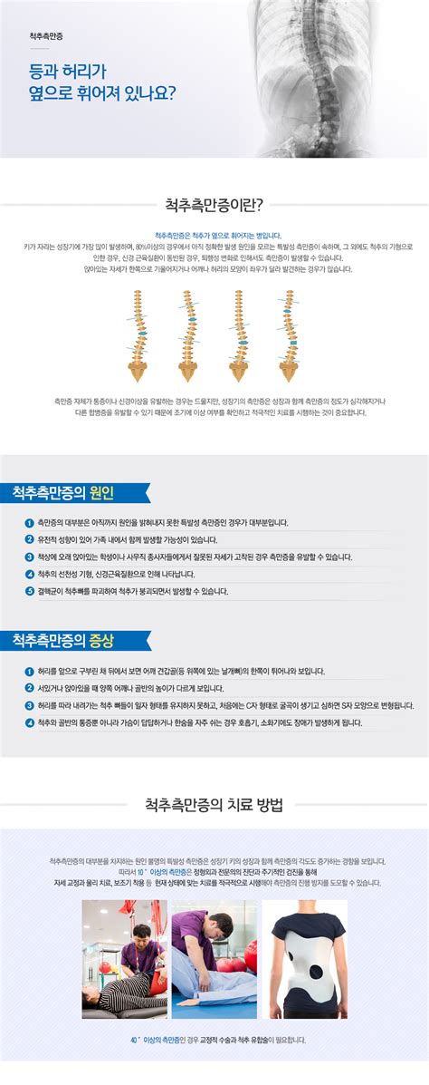 관절·척추·골절수술 연세한강병원 척추질환 척추측만증