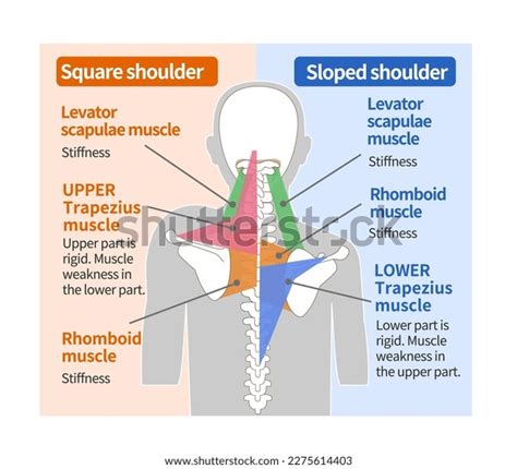 Muscular Structure Square Shoulder Sloped Shoulder Stock Vector