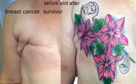 Pin On Mastectomy Tattoo