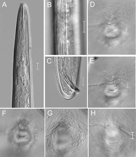 Light Photomicrographs Of Meloidogyne Paramali N Sp Male And Female