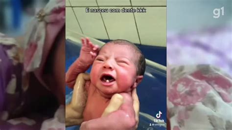 Vídeo Vídeo que mostra bebê que nasceu dentes tem milhões de