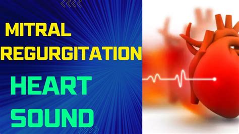 Mitral Regurgitation Murmur Heart Sounds Cardiology Youtube