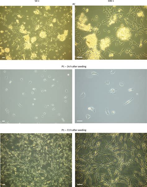 The Morphology Of Canine Articular Cartilage Derived Cells In Primary