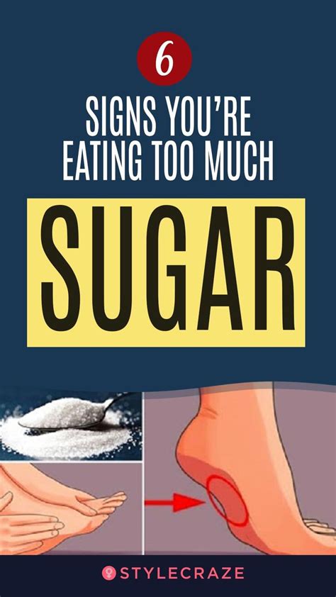 Signs Youre Eating Too Much Sugar Sugar Health Health And Fitness