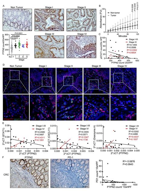 Enhanced PTPN2 Expression In Human Colorectal Carcinoma A