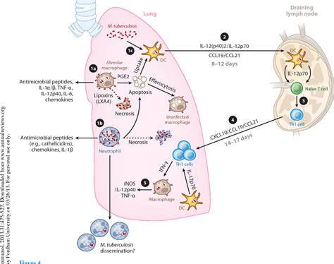 Tuberculosis Diagram