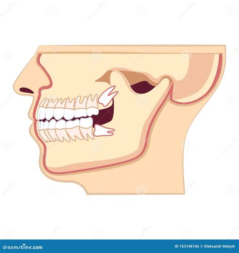 Cabe A Humana Mand Bula Erup O Anormal Dos Dentes Odontologia