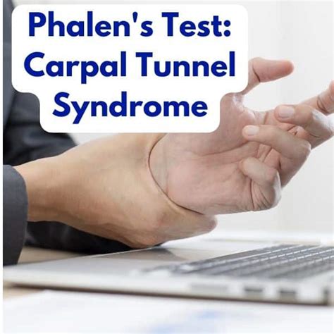 Phalens Test A Diagnostic Tool For Carpal Tunnel Syndrome