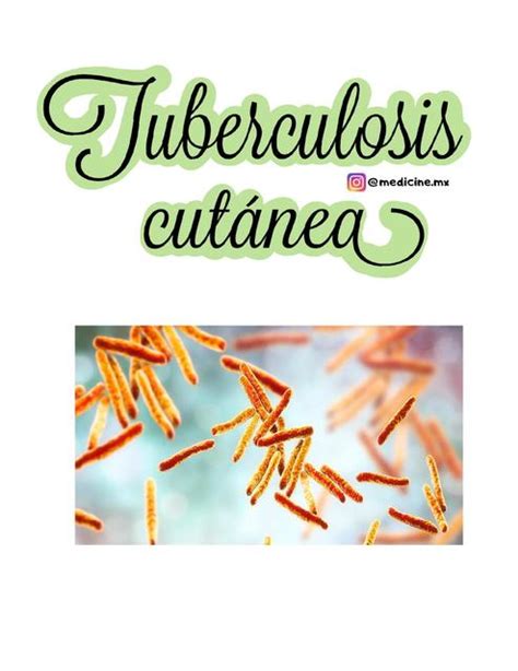 Tuberculosis Cut Nea Dra Ligeia Vieytez Udocz