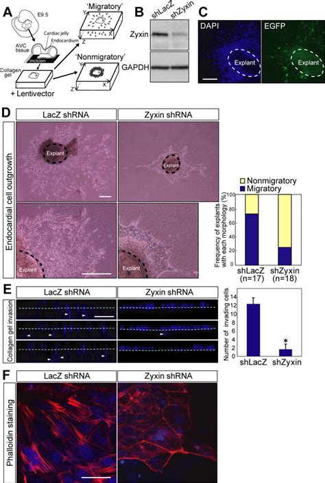 Zyxin Mediates Actin Fiber Reorganization In Epithelialmesenchymal