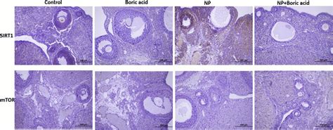 Photomicrographs Of Sections In The Ovarian Tissue Sirt1 And Mtor