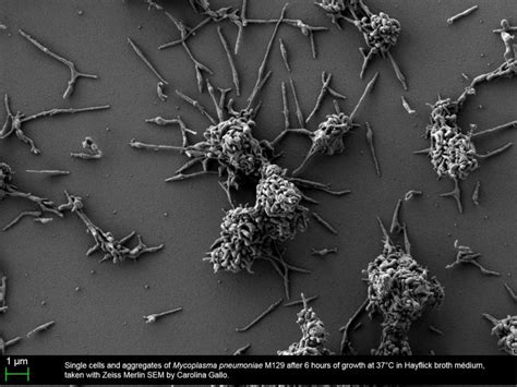 mycoplasma microscope.jpg | MycoSynVac