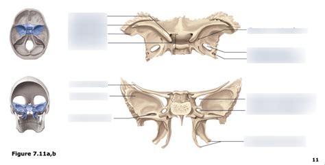 Lab 5 The Sphenoid Bone Diagram Quizlet