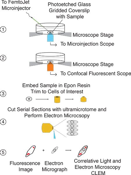 Correlative Light And Electron Microscopy Clem As A Tool To Visualize