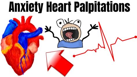 Heart Palpitation Symptoms Caused By Anxiety Scary Feeling Youtube