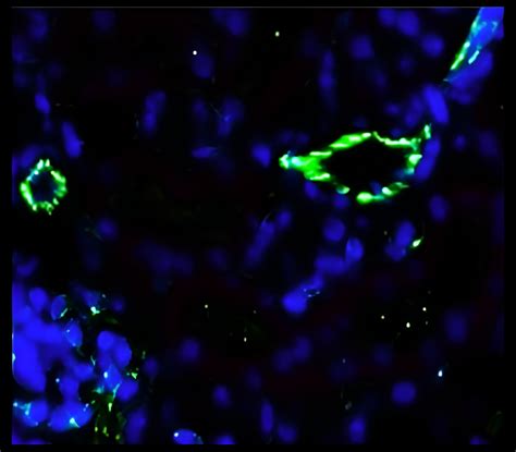 Angiogenesis Antibody Panel IRAP5018 IReal Biotechnology Inc