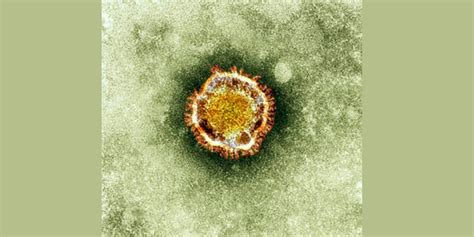 Oman Reports First Mers Coronavirus Case Fox News